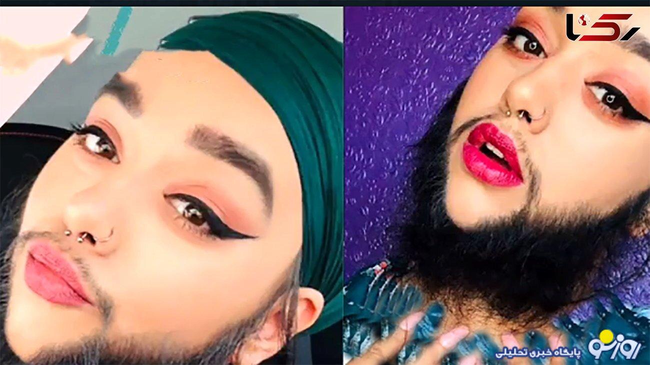 ازدواج دختر ریش دار جهان ! + لباس عروس زیبایش را ببینید ازدواج دختر ریش دار جهان ! + لباس عروس زیبایش را ببینید